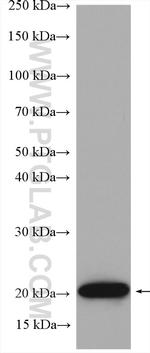 RAB31 Antibody in Western Blot (WB)