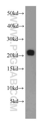 RAB31 Antibody in Western Blot (WB)