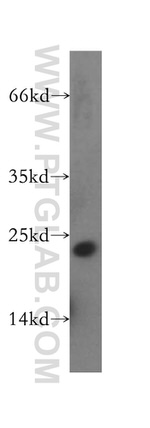 RAB31 Antibody in Western Blot (WB)