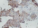 F11R Antibody in Immunohistochemistry (Paraffin) (IHC (P))