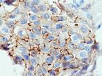 F11R Antibody in Immunohistochemistry (Paraffin) (IHC (P))