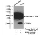 F11R Antibody in Immunoprecipitation (IP)