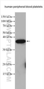 F11R Antibody in Western Blot (WB)