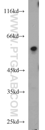 FRK Antibody in Western Blot (WB)