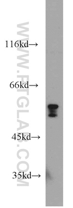 FRK Antibody in Western Blot (WB)