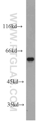 FRK Antibody in Western Blot (WB)