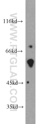 FRK Antibody in Western Blot (WB)