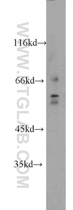 FRK Antibody in Western Blot (WB)