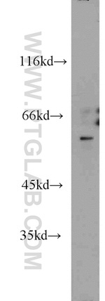 FRK Antibody in Western Blot (WB)