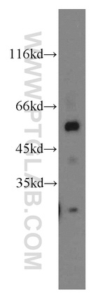 FRK Antibody in Western Blot (WB)