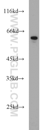 FRK Antibody in Western Blot (WB)