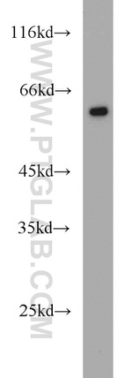 FRK Antibody in Western Blot (WB)