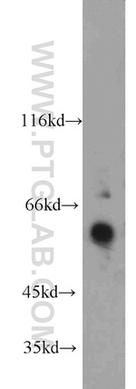 FRK Antibody in Western Blot (WB)