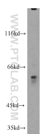 FRK Antibody in Western Blot (WB)