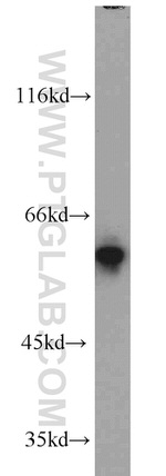 FRK Antibody in Western Blot (WB)