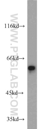 FRK Antibody in Western Blot (WB)