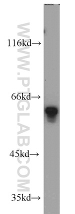 FRK Antibody in Western Blot (WB)