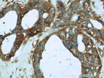 HTF9C Antibody in Immunohistochemistry (Paraffin) (IHC (P))