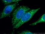 ALAS1 Antibody in Immunocytochemistry (ICC/IF)