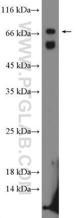 ALAS1 Antibody in Western Blot (WB)