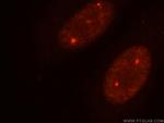 TOE1 Antibody in Immunocytochemistry (ICC/IF)