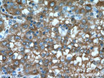 ASS1 Antibody in Immunohistochemistry (Paraffin) (IHC (P))