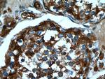 ASS1 Antibody in Immunohistochemistry (Paraffin) (IHC (P))