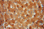 ACAT1 Antibody in Immunohistochemistry (Paraffin) (IHC (P))