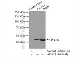 ACAT1 Antibody in Immunoprecipitation (IP)