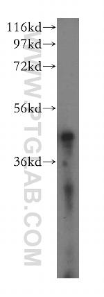 ACAT1 Antibody in Western Blot (WB)