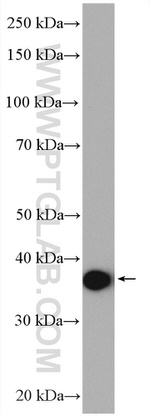 ACAT1 Antibody in Western Blot (WB)