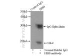 HBB Antibody in Immunoprecipitation (IP)