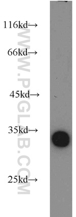 LDHAL6A Antibody in Western Blot (WB)