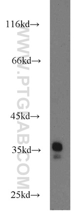 LDHAL6A Antibody in Western Blot (WB)