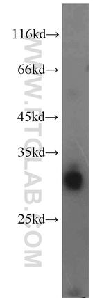 LDHAL6A Antibody in Western Blot (WB)