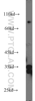 LDHAL6A Antibody in Western Blot (WB)