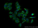 MCL1 Antibody in Immunocytochemistry (ICC/IF)