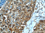 MCL1 Antibody in Immunohistochemistry (Paraffin) (IHC (P))