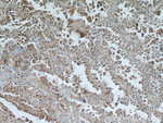 MCL1 Antibody in Immunohistochemistry (Paraffin) (IHC (P))