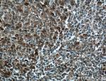 MCL1 Antibody in Immunohistochemistry (Paraffin) (IHC (P))