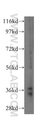 MCL1 Antibody in Western Blot (WB)