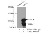 PDE4A Antibody in Immunoprecipitation (IP)