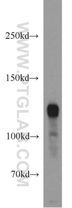 PDE4A Antibody in Western Blot (WB)