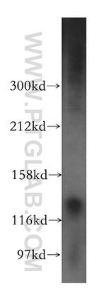 PDE4A Antibody in Western Blot (WB)