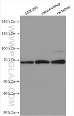 HEXB Antibody in Western Blot (WB)