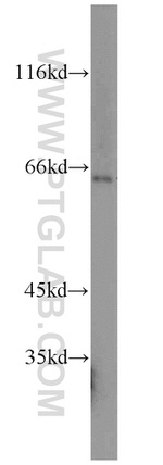 HEXB Antibody in Western Blot (WB)