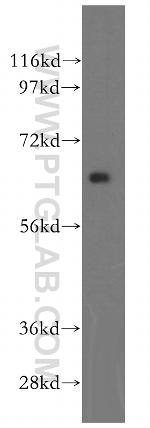 HEXB Antibody in Western Blot (WB)