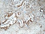 CAP1 Antibody in Immunohistochemistry (Paraffin) (IHC (P))