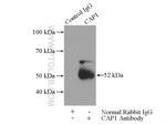 CAP1 Antibody in Immunoprecipitation (IP)