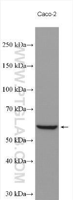 CAP1 Antibody in Western Blot (WB)